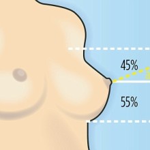 Типы и формы женской груди
